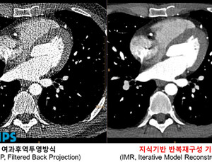 필립스, 31일 ‘필립스 CT 이노베이션 심포지움’ 개최