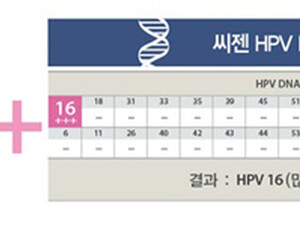 자궁경부암 국가암검진, 센스 있는 선택은 HPV DNA 검사와 함께