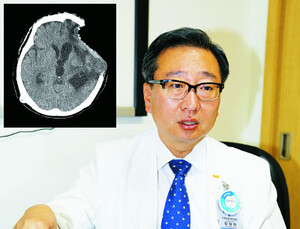[3D프린팅 의료를 만나다①] 3D프린팅을 이용한 두개골 수술, 그 이후