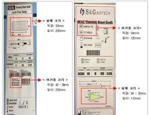허가사항과 다른 혈관용 스텐트 제조, 대학병원에 납품한 업체 적발