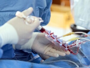 비허가 스탠트 유통 10년, 눈 뜬 장님 된 정부