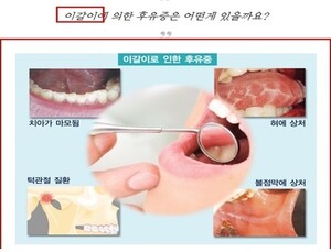 '이갈이’, ‘코골이’ 방지 등 의학적 효능 오인 광고 의료기기 판매 사이트 적발