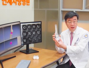 [쿠키리포트] 연세사랑병원, 개인맞춤 3D 인공관절 개발 연구 본격 시동