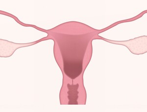 젊은 여성 위협하는 자궁·난소 질환은?