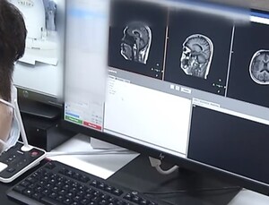 MRI 촬영 중 화상 입고 안전사고 발생…의료인 책임 모호