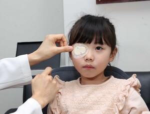 약시 치료성공률, 4년만에 95→23% ‘뚝’…만 7세 이전 치료해야