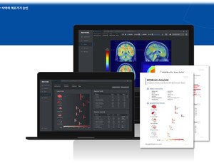 ‘주사 대신 AI’…건국대병원, 알츠하이머 진단 솔루션 BTX BRAIN 도입