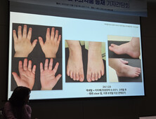 소아 때부터 평생 고생하는 아토피…“과학적 근거 입증 보습제 선택 중요”