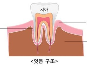 잇몸 통증 계속된다면? 복용약도 체크해야
